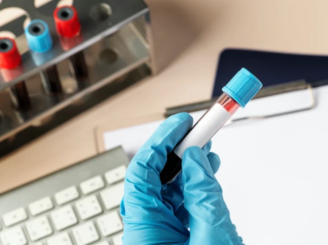 Anemia în sarcină: cauze, simptome, tratament și prevenție