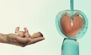 Fertilizare in Vitro