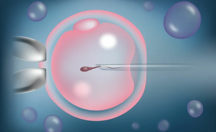 injecția intracitoplasmatică de spermă